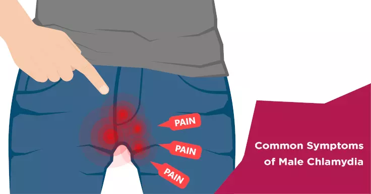 Chlamydia in Men: Causes, Symptoms, Diagnosis, Treatment, and Prevention